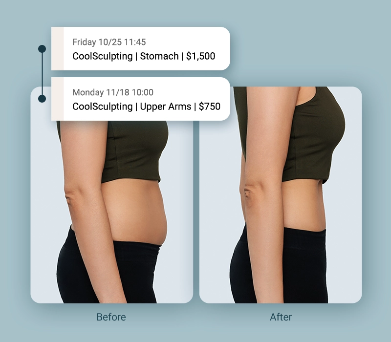 before and after weight loss - Med Spa CoolSculpting Appointments